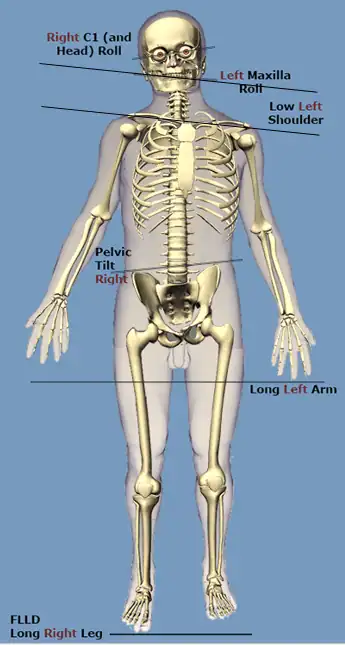 Chans Dental Model